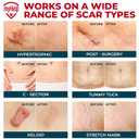 Medical Grade Silicone Scar Tape - 1.6x150 - Visible Difference on Keloid & -Section - Reusable Silicone Scar Sheets - Easy to Use