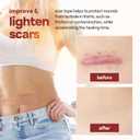 2 x AllSett Health Silicone Sheets for Scars, Post Surgery, Tummy Tuck, C-Section Recovery, Keloid Bump Removal, Stretch Marks Removal (6 Inch x 1.6 Inch), Pack of 6