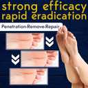 3 x Wart Remover Propolis Infused Wart Removal Stick with 40% Salicylic Acid | Treats Stubborn Warts on Hands, Feet & Body | Painless, Fast Acting, Maximum Strength | Portable & Easy to Apply 10 g