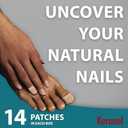Kerasal Multi-Purpose Nail Repair Patches - 14 Count - Nail Repair for Damaged Nails, 8-Hour Nail Treatment Restores Healthy Appearance