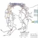 Warm White Icicle Lights 11.5 FT, UL Listed and Commercial Grade 100 LED Christmas Lights, for Indoor and Outdoor Party, Patio, Courtyard, Window, Fence, Trees.