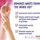 Boiron WartCalm for Painless Wart Removal on Hands, Knees, Plantar (Feet), and Other Bodily Warts for Adults & Children Ages 2+ - 120 Count (2 Pack of 60)