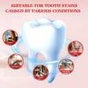 Sp-6 Probiotics Whitening Toothpaste, Sp-6 Ultra Whitening Toothpaste, Enhanced Formula with Enamel-Safe, Fluoride-Free, Fresh Breath Mint Flavor for Oral Health (3)