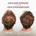 Klorane Strengthening Shampoo with Quinine - Dermatologist-Tested - Natural Alternative Thickening Shampoo for Hair Thinning - Support Stronger, Healthier Hair for Men & Women - 13.5 fl. oz.