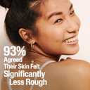Cetaphil Exfoliating Rough & Bumpy Cream, Lightweight Cream for All Skin Types, 8 oz Tube, 20% Urea, Gently Exfoliates, Refines Skin Texture, Dermatologist Recommended Brand