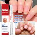 Fungal Nail Renewal Pen for Toes & Fingernails, Nail Care Brush Pen to Help Restore Discoloration, Strengthen Thick & Brittle Nails, Supports Clearer and Healthier Looking Nails (2 PCS)