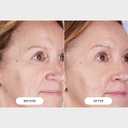 CurrentBody Skin LED Light Therapy Mask: Series 2