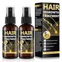 5% Minoxidil for Men & Women, Advanced Formula Hair Regrowth Spray and Topical Solution for Thinning Hair and Beard, Long-Lasting Results
