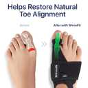 Bunion Corrector for Women Big Toe  2-Pack Adjustable Bunion Splints & Bunion Brace for Pain Relief and Toe Alignment  Day & Night Support for Hallux Valgus and Foot Discomfort  Also for Men