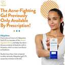 Acne Free Adapalene Gel 0.1%, Once-Daily Topical Retinoid Acne Treatment, Dermatologist Developed, Unclogs Pores and Clears Acne, Prevents and Improve Whiteheads and Blackheads, 1.6 Ounce, BBD: 08/2026