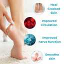 Norelie Urea Cream 42% with 2% Salicylic Acid - Foot and Heel Moisturizer for Dry, Cracked Skin - Non-Greasy Hydrating Cream for Feet, Hands, and Elbows, Softens Calluses and Rough Skin, 3.53oz