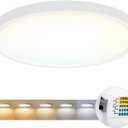 LVWIT 15.8inch Ceiling Light, Led Lights, Flush Mount Ceiling Light, 5CCT Ceiling Light Fixture, 3000K/3500K/4000K/5200K/6000K, 36W Led Lights for Bedroom, Bathroom, Hallway, 1PCS, White, JM-FH400DL (15.8 inch - 1pcs)