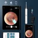 2 x Ear Wax Removal, Ear Cleaner with Camera and Light, Ear Wax Removal Kit with 1296P Otoscope, Ear Cleaning Tool with 6 Ear Spoon, Ear Camera for iPhone & Android Phones,White