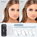 JPNK Blackhead Remover Comedone Extractor Acne Removal Kit Silver