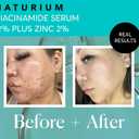 Naturium Niacinamide Face Serum 12% Plus Zinc 2%, Anti-Aging, Pore Minimizer & Dark Spot Corrector with Hyaluronic Acid & Vitamin E, Vegan & Cruelty-Free, 1 oz