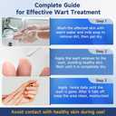 3 x NewX Fast Action Wart Gel Maximum Strength - Wart with Salicylic Acid - Fast-Acting Wart Freeze Off Designed for Warts, Plantar Wart, Genital Wart, Common Wart, Flat Wart, Corn, Callus-G-03