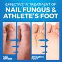 Toenail Fungus Treatment Extra Strength - Advanced Foot & Shoe Deodorizer Spray - XL - Athletes Foot Shoe Spray for Fungal Treatment - 5.07 Fl oz