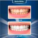 Professional Teeth Whitening Strips 7 Treatments - Enamel Safe - Non-Sensitive Formula - Peroxide-Free Whitening Strips - Dentist Formulated Teeth Whitening Kit (14 Strips)