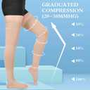 GODORIO 2Pairs 20-30mmHg Thigh High Compression Stockings, Thigh High Compression Socks for Women, Medical Compression Stockings for Varicose Veins, Swelling, Pregnant, Teacher, Doctor (XL, Open toe-Beige+Open toe-Black)