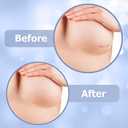 Breast reduction recovery supplies after surgery needs - Silicone scar sheets for surgical scars - Comfortable under Post op Bra