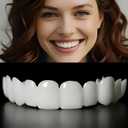 2 Pairs Smile Supporter Can Be Adjusted Freely to Restore Confident Smile (Up and Down) Which is Universal for Adults