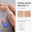 Braun Smart IPL, Skin iExpert Pro 7, VOGUE's Best Hair Removal Device, IPL Hair Removal for Women and Men, Permanent Laser Hair Reduction At-Home, World's 1st Smart App, 4 Heads, IPL7387