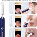 Earsight Plus E33R Ear Wax Removal Tool Camera, FSA HSA Eligible Items, Ear Cleaner with Flexible Ear Camera Otoscope, Visual Ear Pick Tweezers Wax Remover, Ear Cleaning Kit for Family by Bebird