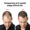 PP405 Hair Treatment, SCU-405 Hair Growth Oil, Infused with PP405 for Hairloss & Baldness, Hair Growth Serum for Women&men 2.11 Fl.Oz / 60ml