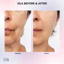 Spa Sciences ISLA Ice + Heat Contouring Roller (Face, Neck, and Dcolletage)  Including Steel + Bonus Genuine Rose Quartz Globes
