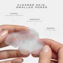 Vue Hydrocolloid Nose Patches - Nose Pore Strips for Blackheads, Sebum and Oil Control, Gentle for All Skin Types (8-Count)