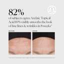 Naturium Azelaic Topical Acid 10%, Face & Skin Care Beauty Treatment with Niacinamide & Vitamin C, 1 oz