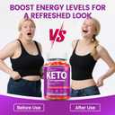 Organic Apple Cider Vinegar Gummies Sugar Free, Keto ACV Gummies: Apple Cider Vinegar with Mother, Vitamin B12 & B6, Beetroot | Gut Health, GMO Free & Vegan, Metabolism, Energy Gummy - 60 Count..