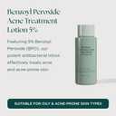 Marini SkinSolutions Benzoyl Peroxide Acne Treatment Lotion 5% - Targets & Treats Acne-Prone Skin - Clears Pores & Excess Oil - Made in the USA - 2 fl oz