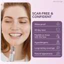Dermaflage Scar Filler Kit - Light - Deep Scar Cover and Waterproof Concealer for Acne Scars Wrinkles, and Ice Pick Scars Makeup, 1 mo supply