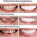 2 x 2 Pairs, Temporarily Adjustable for Men and Women, Top and Bottom, Nature and Comfortable