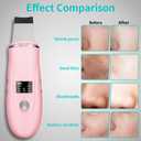 Face Scrubber Skin Spatula - Blackhead Remover Deep Cleansing Tool for Pore Extraction, 4-in-1 Fast Charging Dock Blackhead Remover Face Spatula for Facial Skincare Women Gift (Pink)