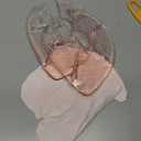 Momcozy Larger Breast Therapy Packs, Hot and Cold Breast Pads with 2 Soft Covers, Breastfeeding Essentials，2 Pack，Pink