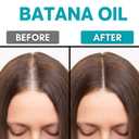 4 x Raw Batana Oil for Hair Growth - From Honduras, Dr Sebi,100% Pure Batana Hair Mask, Scalp Oil Prevents Hair Loss Wild Growth Hair Oil Increases Hair Thickness - 4.23 fl oz