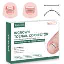Dual Nitinol Ingrown Toenail Corrector,Ingrown Toenail Treatment,Curved Toenail Straightener,Ingrown Toenail Removal Kit,Big Toe Ingrown Toenail Tool (0.55in,0.66in)