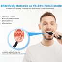 Voraiya Electric Tonsil Stone Remover, Tonsil Stone Vacuum, 10 in 1 Electronic Tonsil Stone Removal Kit, 5 Modes Cleaner for Tonsil