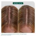 Biolage Scalp Sync Universal Conditioner - Nourishing & Hydrating for All Scalp Types, Lightweight Moisturizing & Conditioning, Fermented Tea Blend & Glycolic Acid, Vegan & Paraben-Free