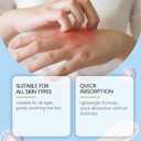 2 x Antifungal Cream, Anti Fungal Skin Cream for Athlete's Foot, Jock Itch, Ringworm, Soothing & Hydrating Formula (1)