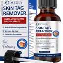 Skin Tag Remover: Skin Tag Remover with Salicylic Acid for Men and Women 30 ML