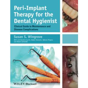 Peri-Implant Therapy for the Dental Hygienist: Clinical Guide to Maintenance and Disease Complications