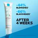 La Roche-Posay Effaclar Salicylic Acid Acne Treatment For Face, Mattifying Acne Gel Cream Spot Treatment for Blackheads, Whiteheads & Pores, Prevents New Pimples, Non-Greasy, Sensitive Skin Safe