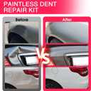 VEXTRO Dent Puller Kit, Dent Removal Kit for Car Auto Body - Paintless Dent Repair with Slide Hammer, Dent Puller Tabs for Hail Damage, Door Dings, Auto Dent Pulling and Car Dent Repair PDR kit -2
