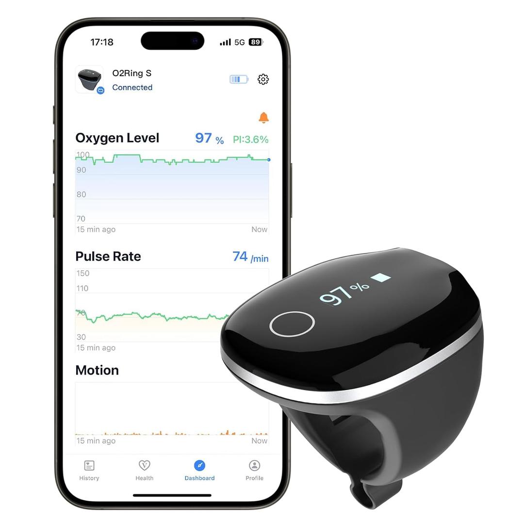 Wellue O2Ring-S Oxygen Monitor for Small Fingers | Rechargeable Pulse Oximeter, Continuous Blood Oxygen & Pulse Rate Tracking with Vibration Reminder | 24 hrs Battery Life, 4 * 10 Hours Data Storage