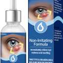 Stye Eye Treatment, Natural Stye Remover, Eye Stye Relief Serum, Premium Formula - Gentle Cleanser for Chalazion & Blepharitis (1 Fl Oz (Pack of 1))