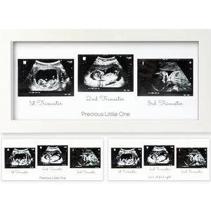 KeaBabies Baby Sonogram Picture Frames - Trio Ultrasound Picture Frame, First Time Mom Gift, Cute Pregnancy Reveal Photo Frame, Baby Gender Reveal & Mother's Day, Newborn Nursery Decor (Alpine White)