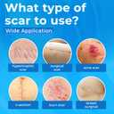3 x Silicone Scar Sheets Roll (1.6"x158" 4m) - Reusable Waterproof Scar Tape, Strips for C-Section, Surgery, Keloid, Burn & Acne Scars Removal